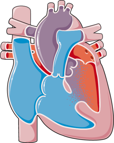 Congenital Heart Disease
