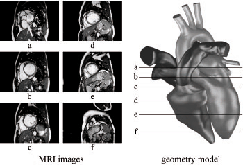 Human Heart Model