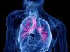 Emphysema