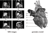 Human Heart Model